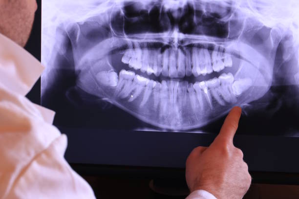 Urgent Tooth Repair in ID